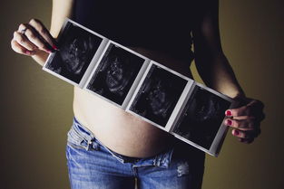 宝宝拍X光片有辐射影响发育吗一年能拍几次？